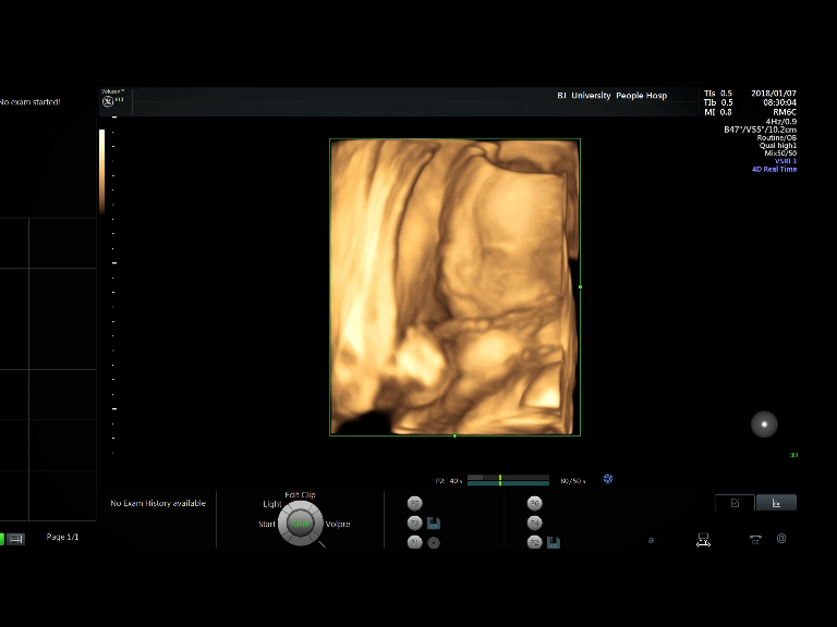 四维彩超图片