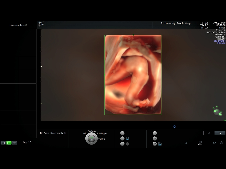 四维彩超图片