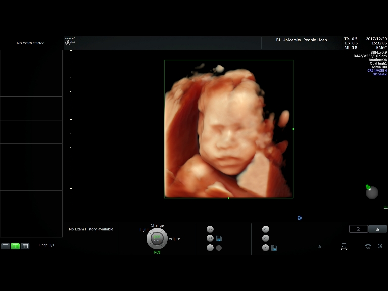 徐州九龙妇产医院四维彩超图片